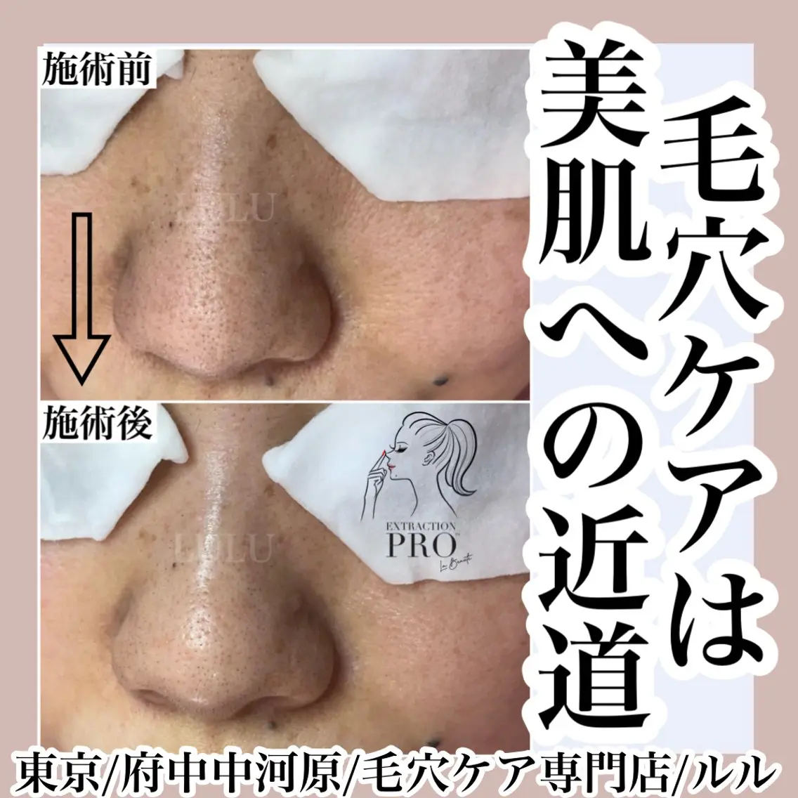 その他 LULU ルルのエステ・リラクイメージ