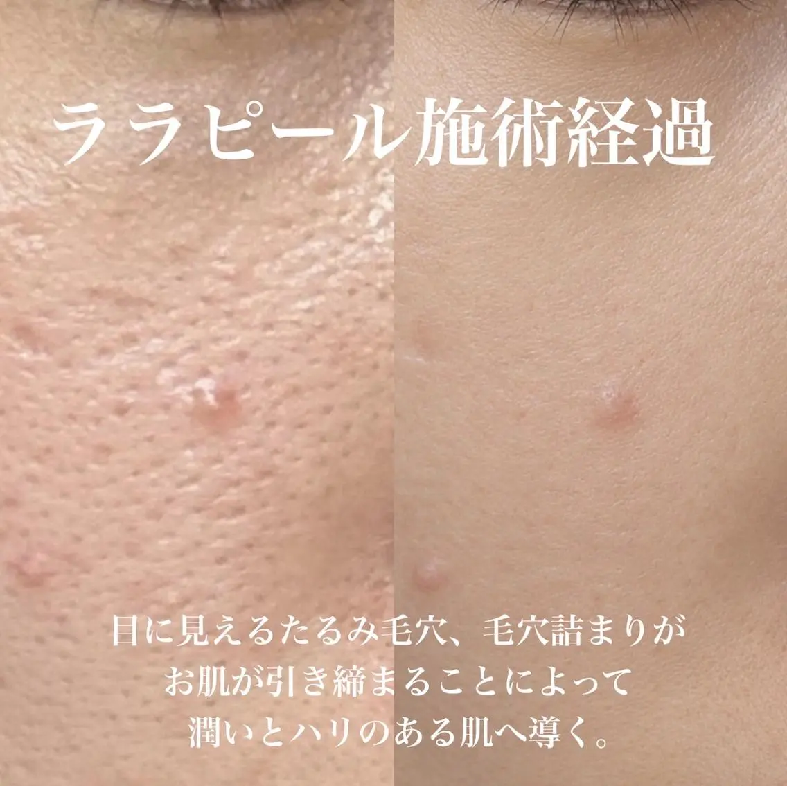 M LABO 銀座店のエステ・リラクイメージ