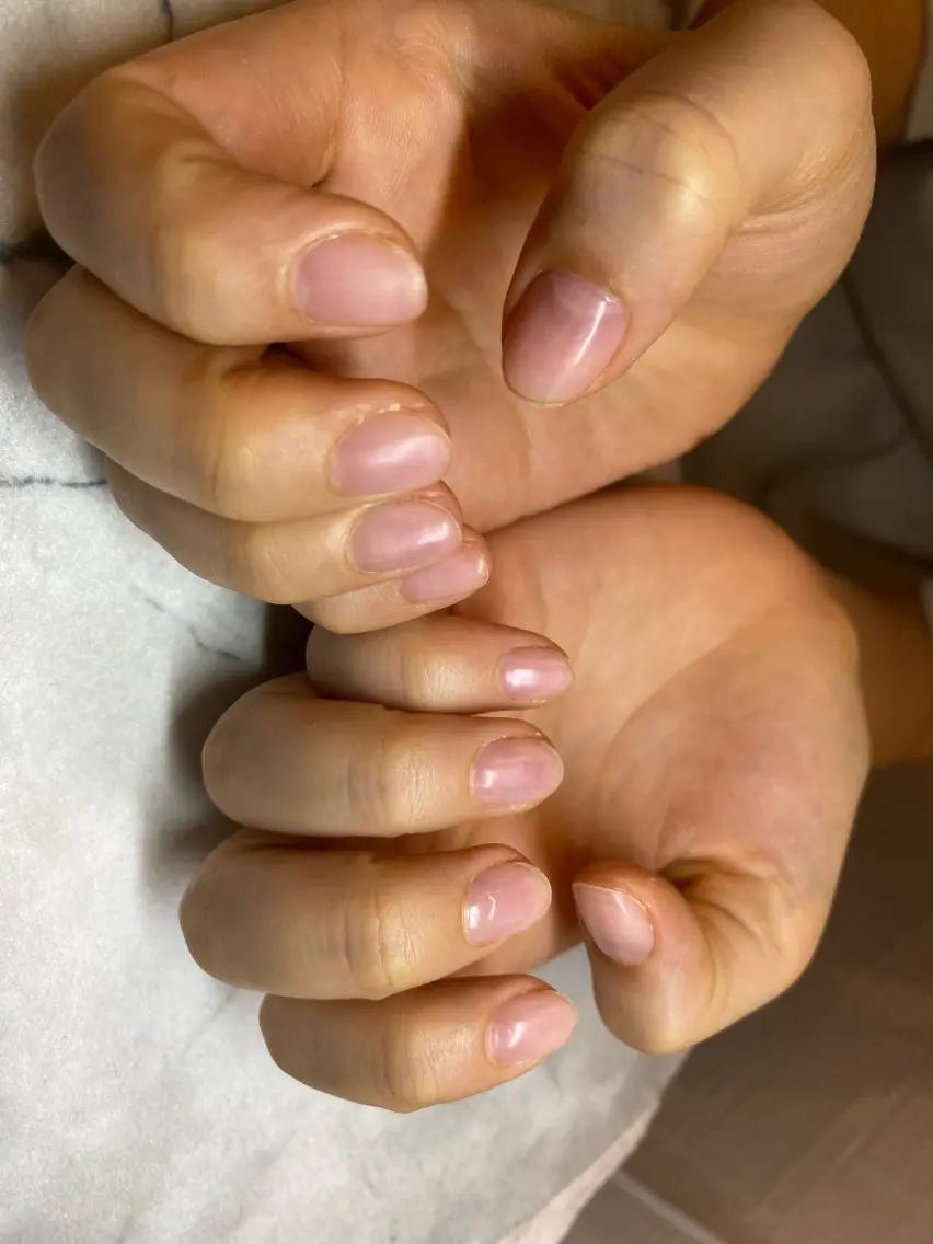 自爪風保護ネイルの写真