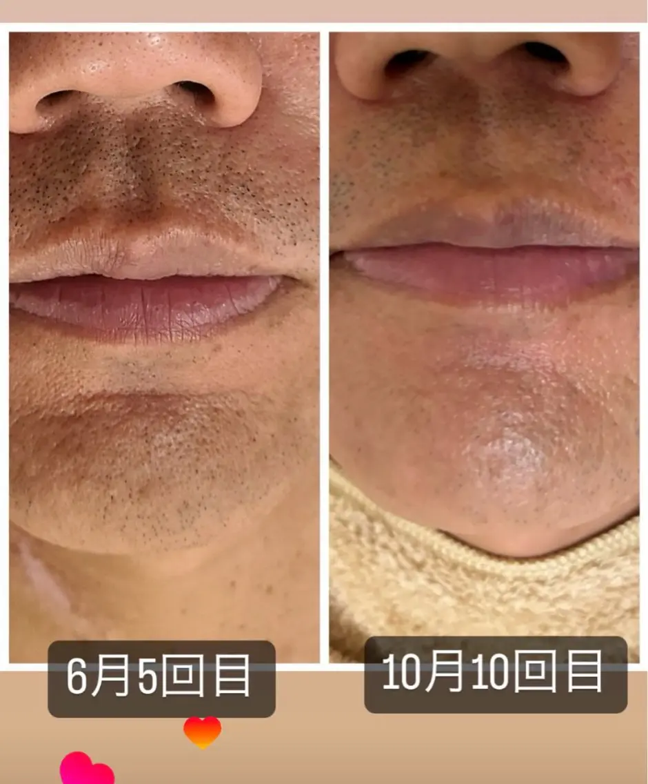メンズ サロンドジュエル ueteのエステ・リラクイメージ