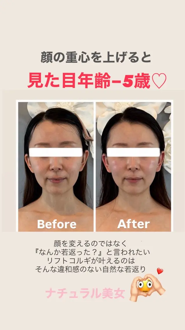 たるみリフトコルギ フワリーのエステ・リラクイメージ