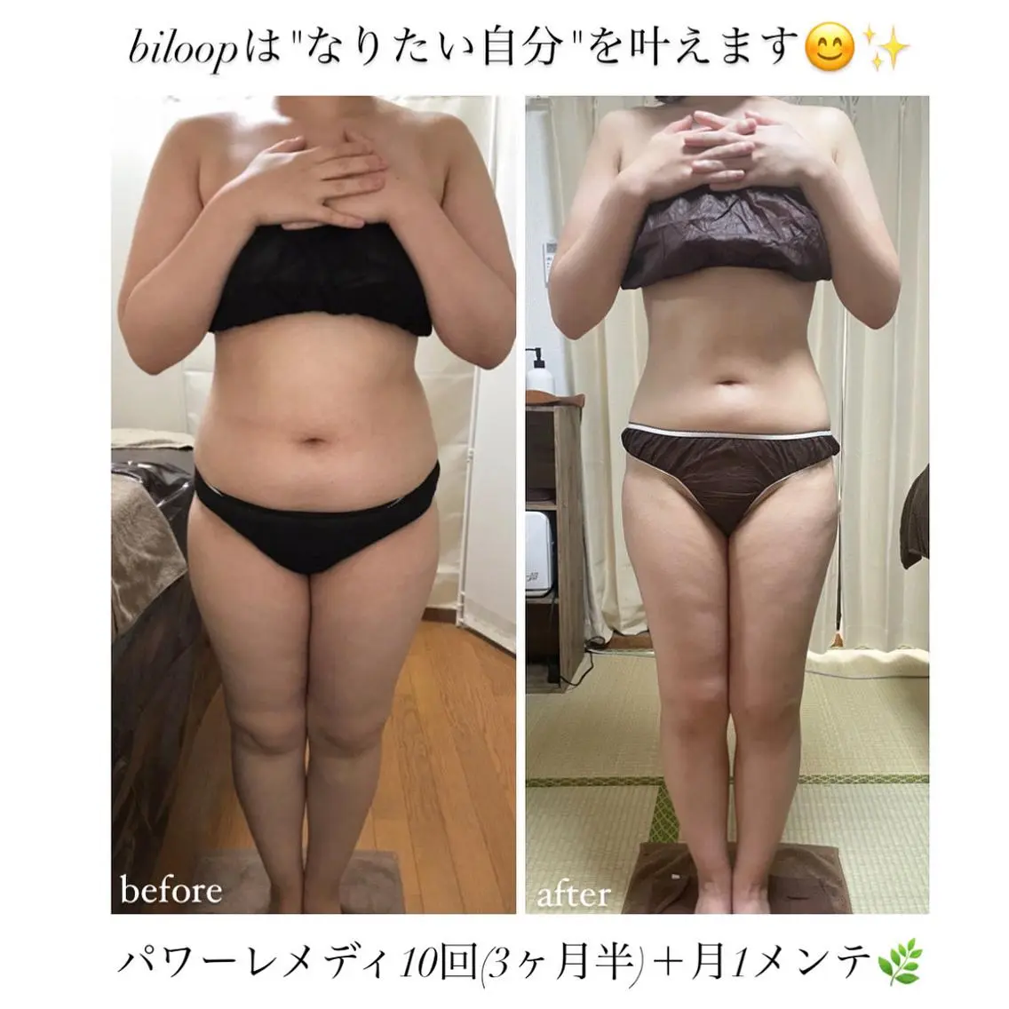 《本気痩せ×疲労改善 》 BILOOPのエステ・リラクイメージ