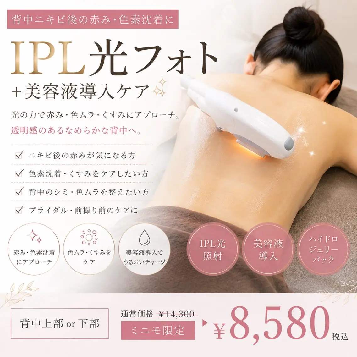 【背中ニキビが落ち着いた後の赤み・色素沈着に✨】IPL光ケア＋美容液導入｜上部or下部の写真