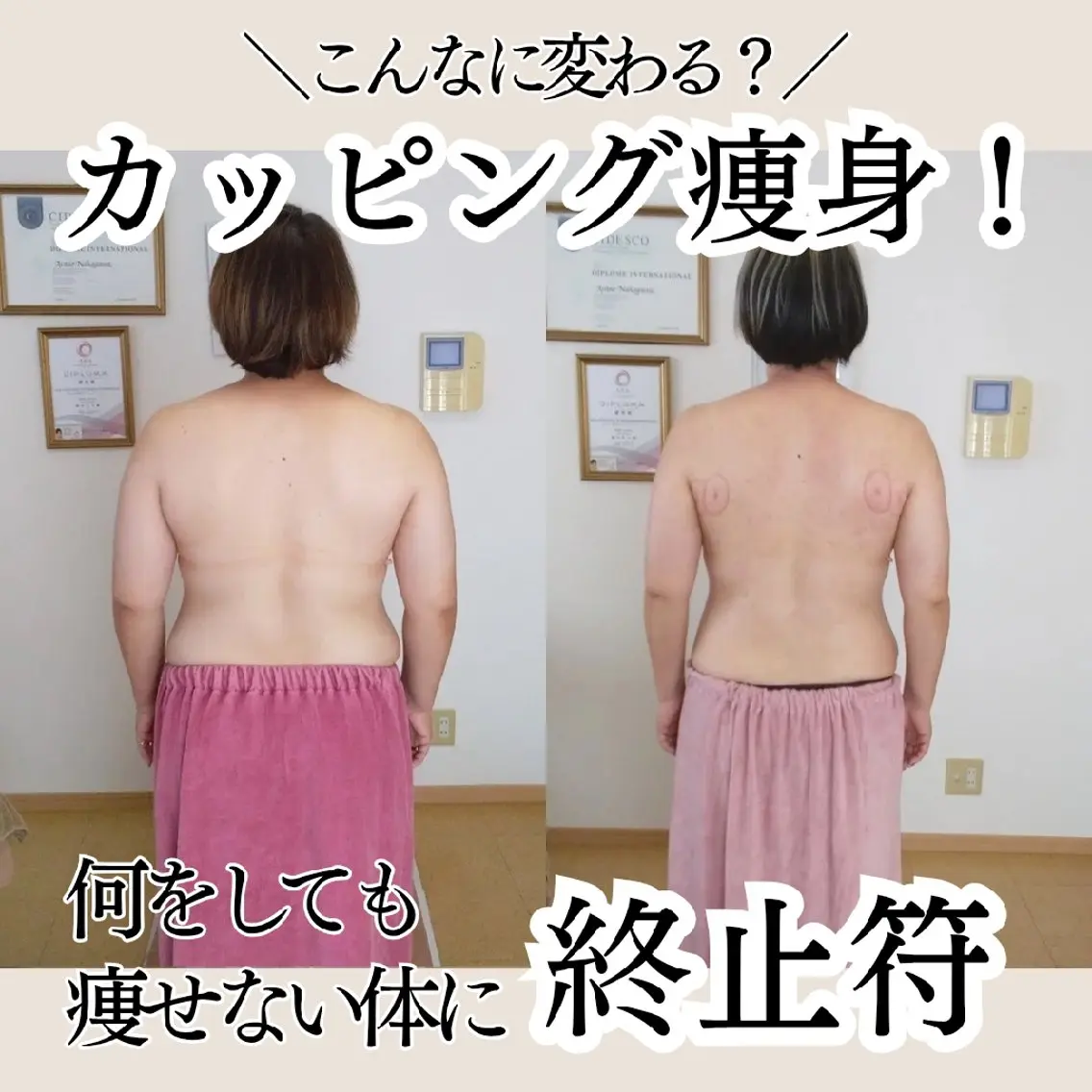 エステ リラク Salon de  HiAのエステ・リラクイメージ