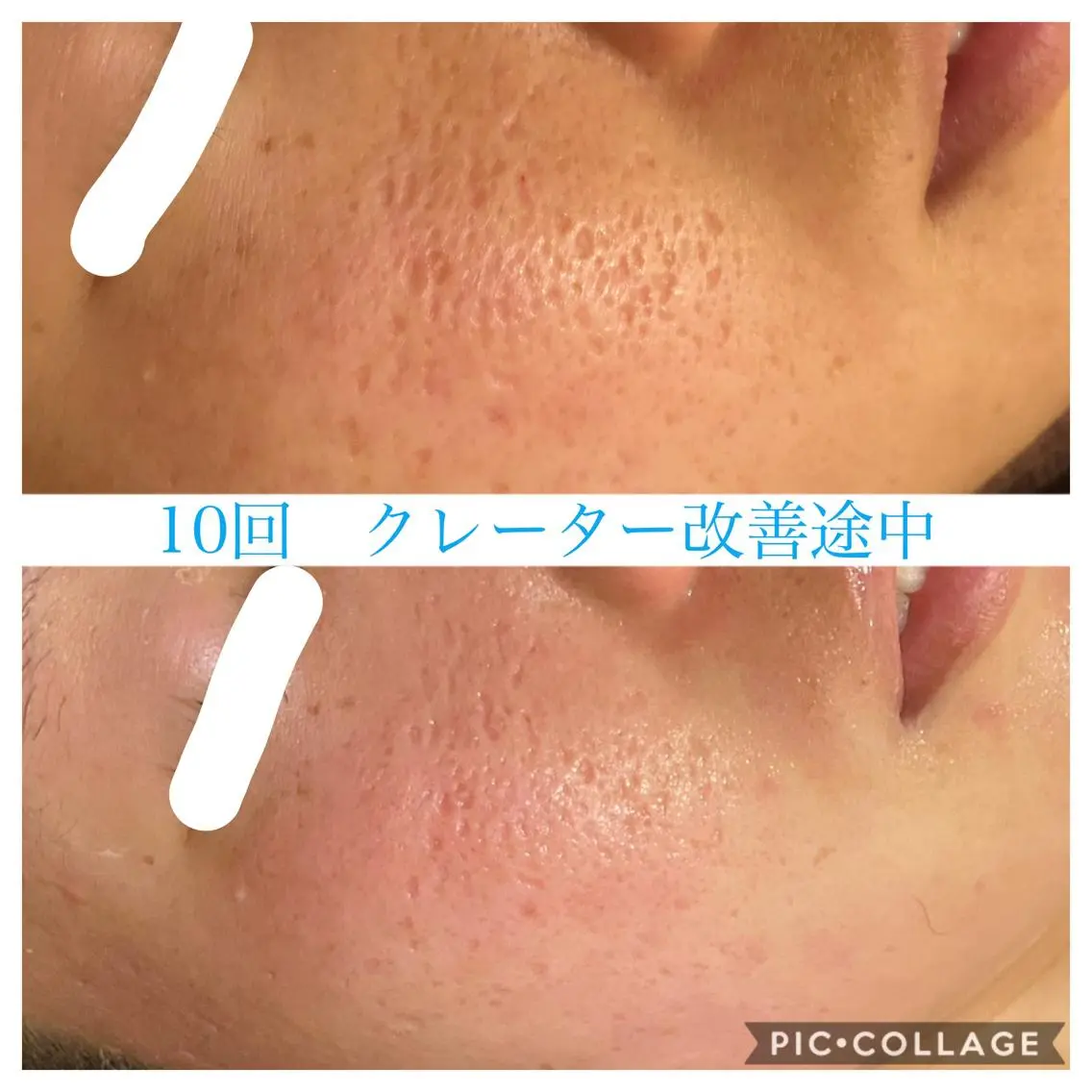 ロング カラー パーマ ヘアアレンジ メンズ キッズ ネイル マツエク・マツパ エステ リラク EnsorClair 代表 野口真央のエステ・リラクイメージ