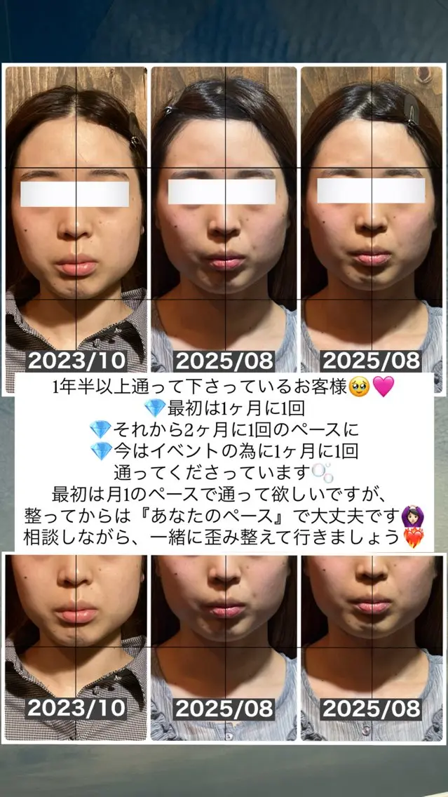 エステ リラク 💎後悔させない小顔 矯正💎イトヤマ🌱のエステ・リラクイメージ