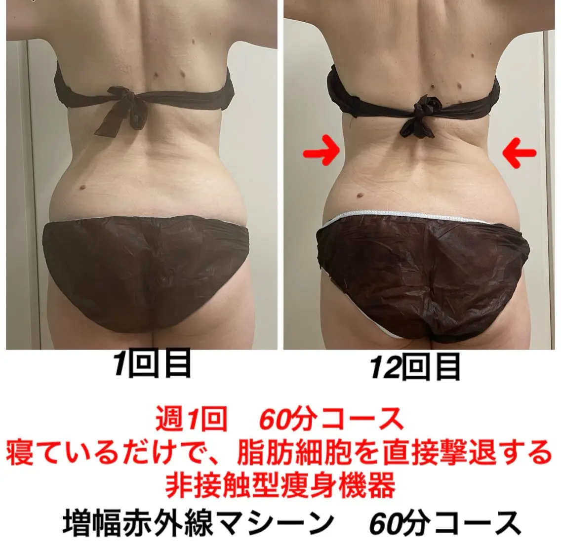 エステ ネイル・エステサロン UILANIのエステ・リラクイメージ