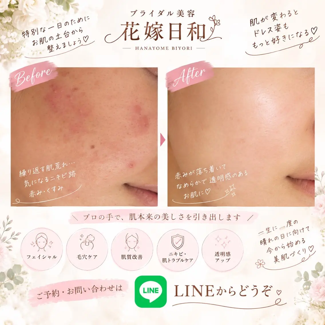 ブライダル美容 花嫁日和のエステ・リラクイメージ