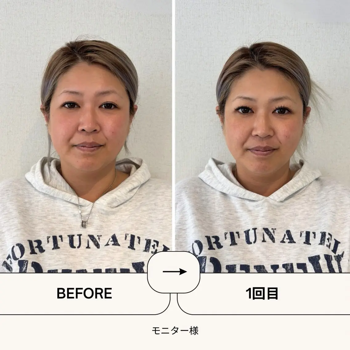 エステ 吉野 京子のエステ・リラクイメージ