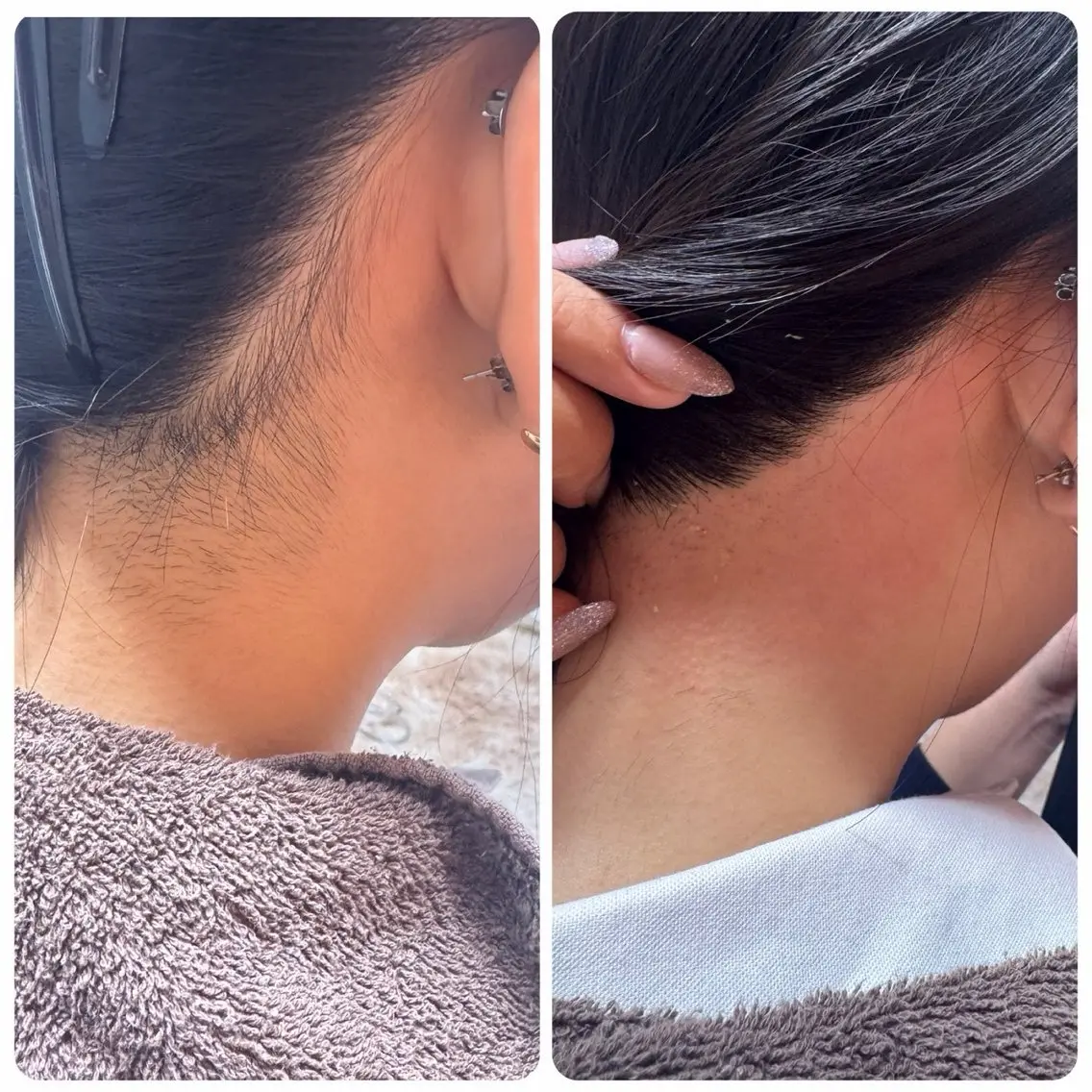 夏に向けて☀️応援📣【女性限定】【うなじ】ワックスで産毛をしっかり取り除き、ポニーテールが似合う後ろ姿へ✨の写真