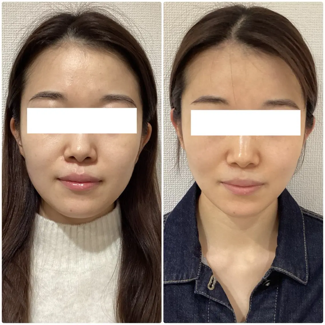 💎小顔サロン アリリン銀座💎のエステ・リラクイメージ