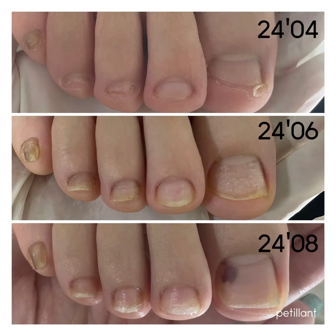 ネイル 卒業式 nail salon petillantのネイルデザイン