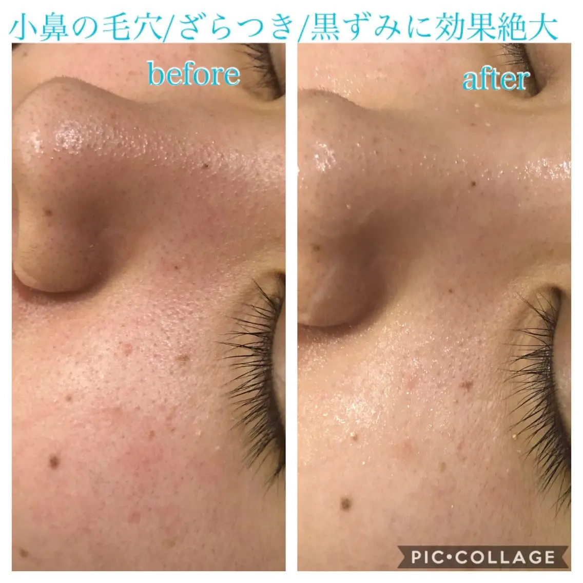 ミディアム カラー パーマ ヘアアレンジ キッズ ネイル マツエク・マツパ エステ リラク EnsorClair 代表 野口真央のエステ・リラクイメージ