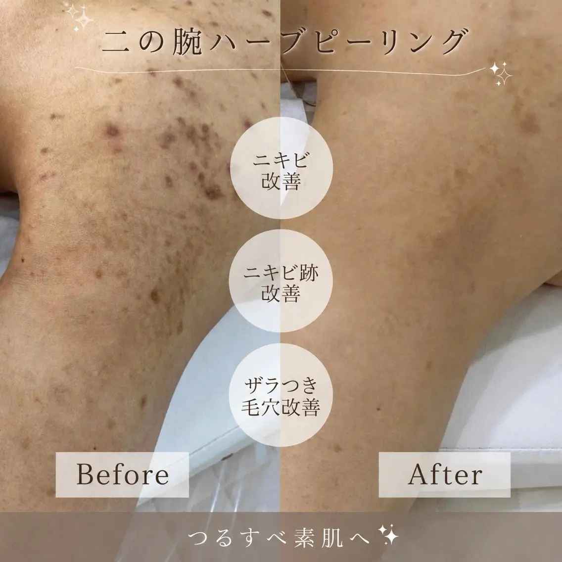 エステ Soin 身体&お肌ケアのエステ・リラクイメージ