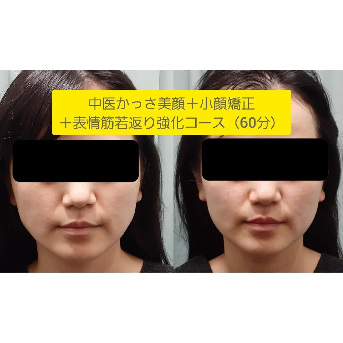 中医気功経絡法 宮医堂のエステ・リラクイメージ