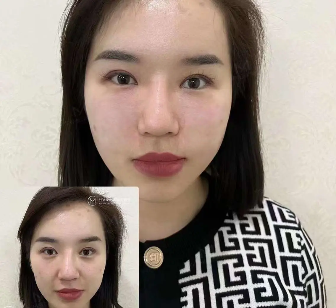 ネイル マツエク・マツパ 赤色 UVネイル 愛維美水光専門店 川崎彩鳳のエステ・リラクイメージ