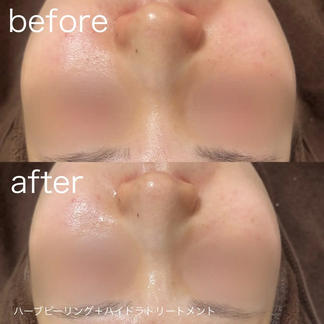 脱毛 lulularico Yuのネイルデザイン