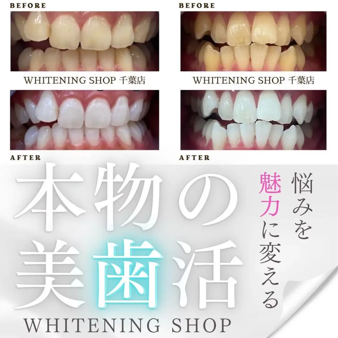 メンズ その他 ホワイトニング ショップ千葉店のその他イメージ