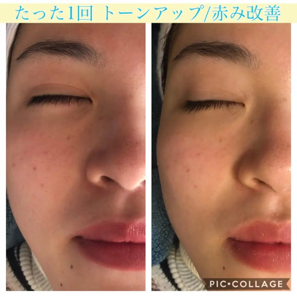 セミロング カラー パーマ ヘアアレンジ キッズ ネイル マツエク・マツパ EnsorClair 代表 野口真央のエステ・リラクイメージ