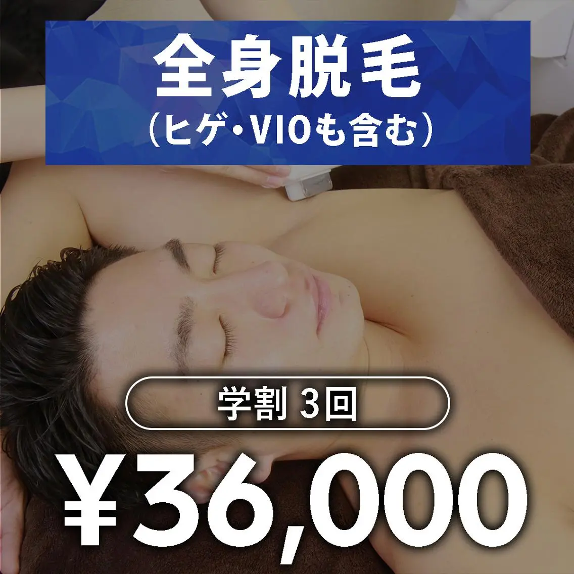 【メンズ脱毛】全身脱毛 学割U24　3回の写真