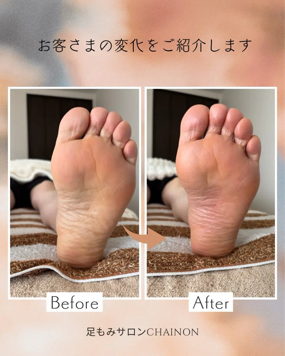 足もみ（下半身）むくみスッキリ60分コースの写真