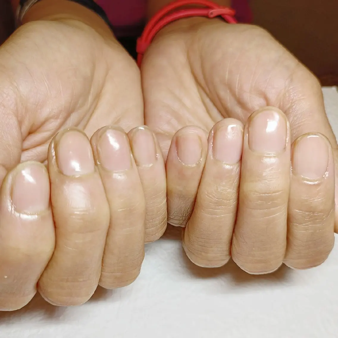 ネイル ハンドネイル ハンドケア 深爪矯正/爪育成ケア manie nailのネイルデザイン