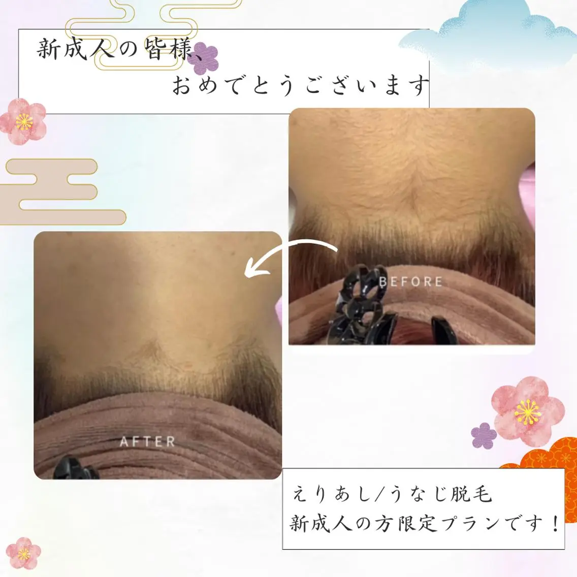 脱毛 🌿小顔・痩身・脱毛 レイビス川崎店🌿のエステ・リラクイメージ
