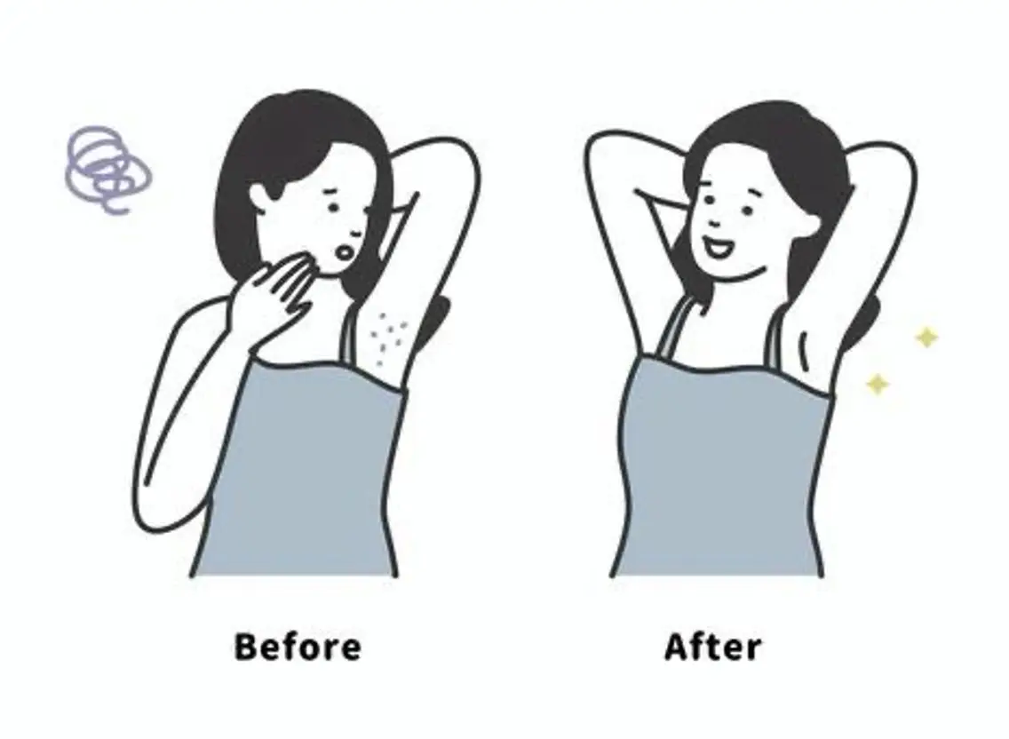 【男性女性どちらでも】ワキのみ💪✨の写真