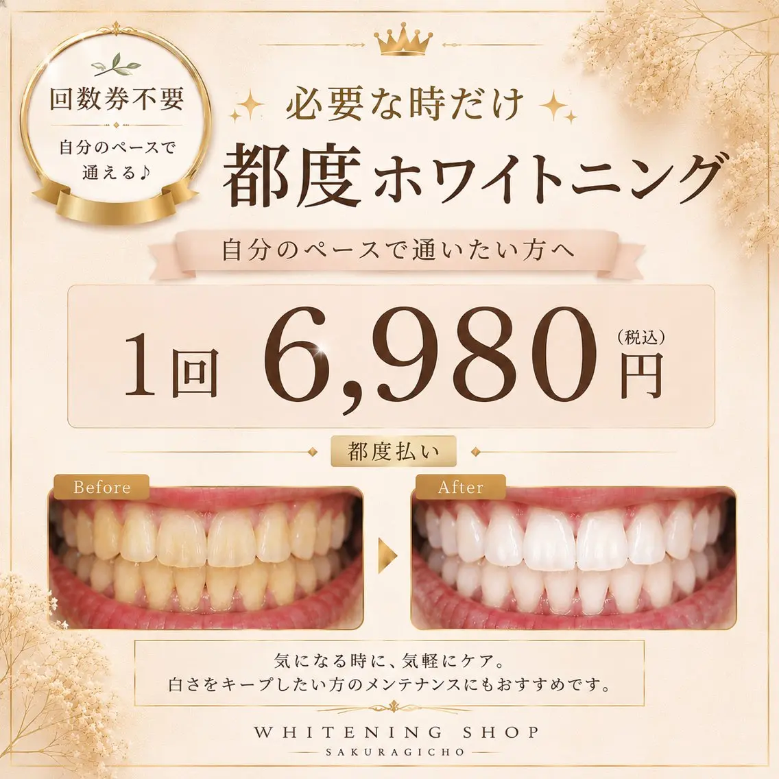 その他 ホワイトニング ショップ桜木町店のエステ・リラクイメージ