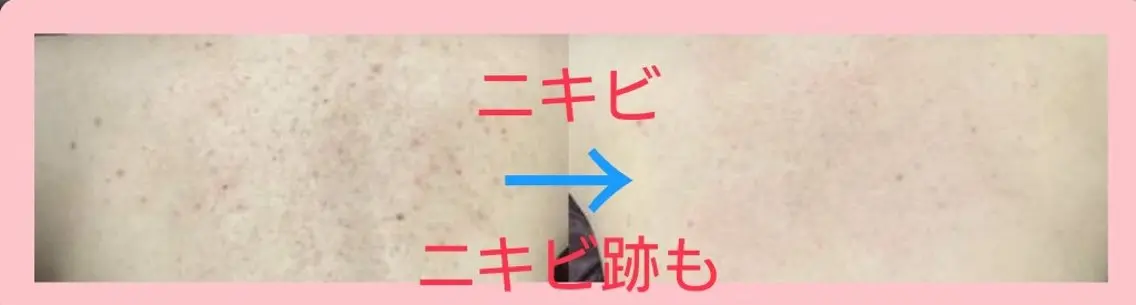 エステ ハーブピーリング 専門店Kikkaのエステ・リラクイメージ