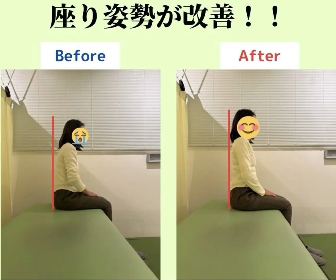 【初回】猫背・姿勢ケア整体!長年の猫背/不良姿勢が気になる方におすすめ!の写真