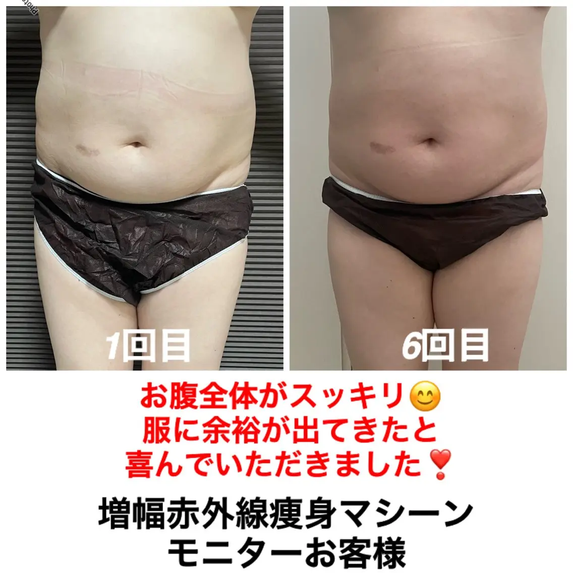 ネイル・エステサロン UILANIのエステ・リラクイメージ