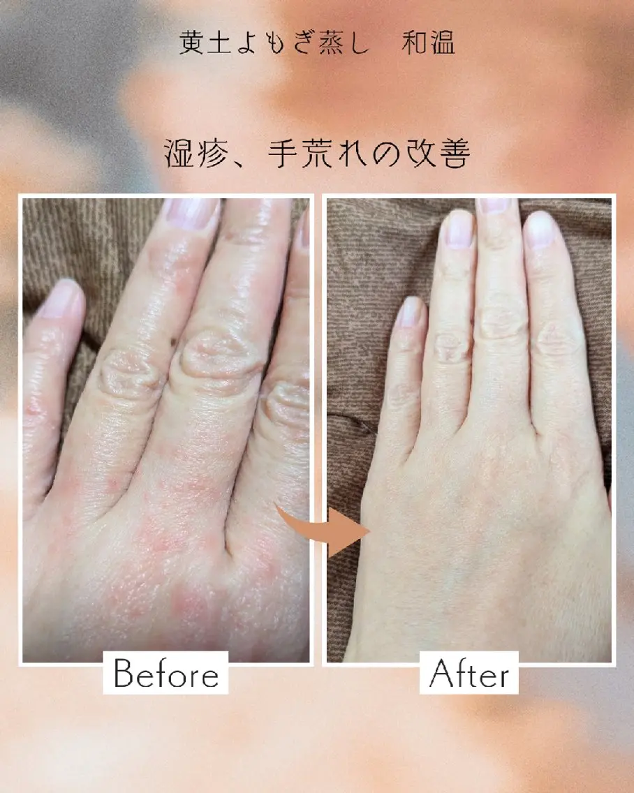 黄土よもぎ蒸し 和温のエステ・リラクイメージ