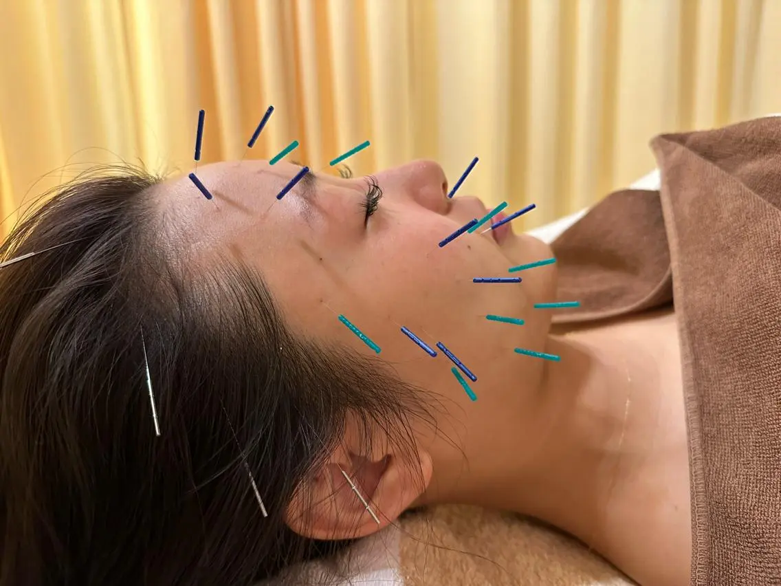 その他 鍼灸サロン BBB3のその他イメージ