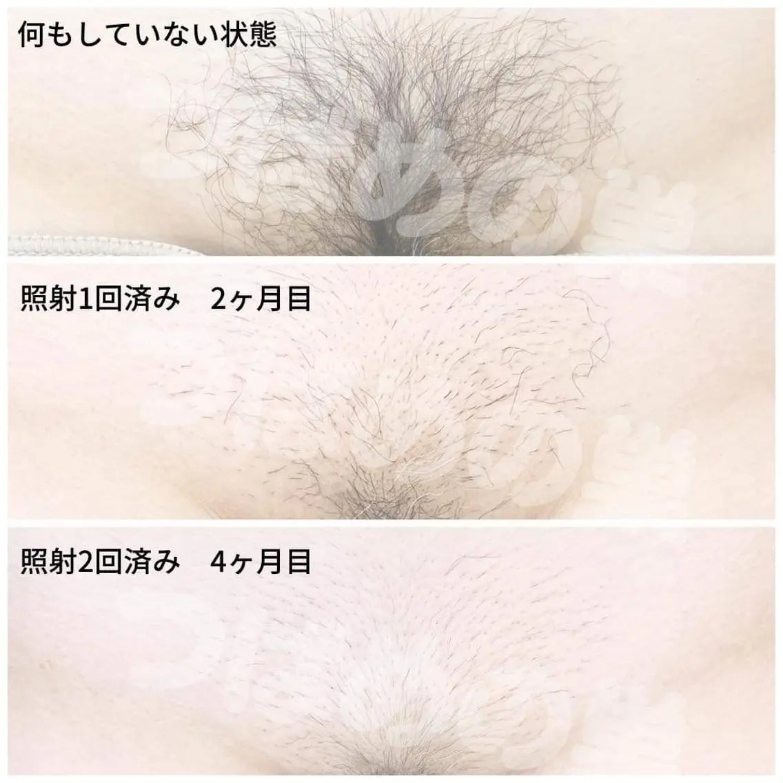 女性専用サロン つばめの巣のエステ・リラクイメージ