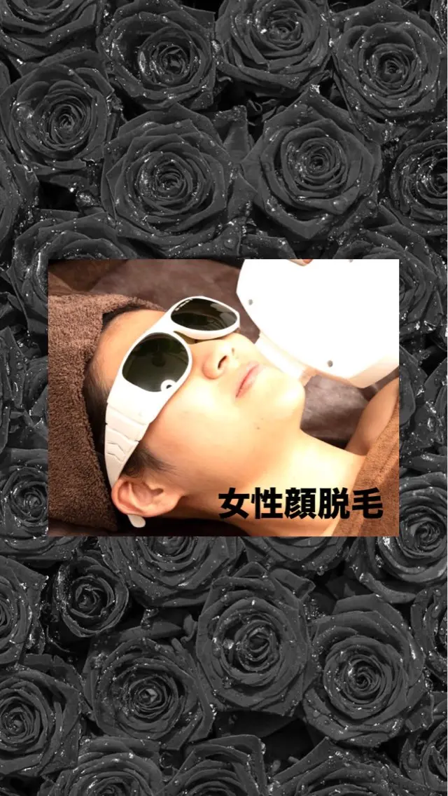 顔脱毛　女性脱毛の写真