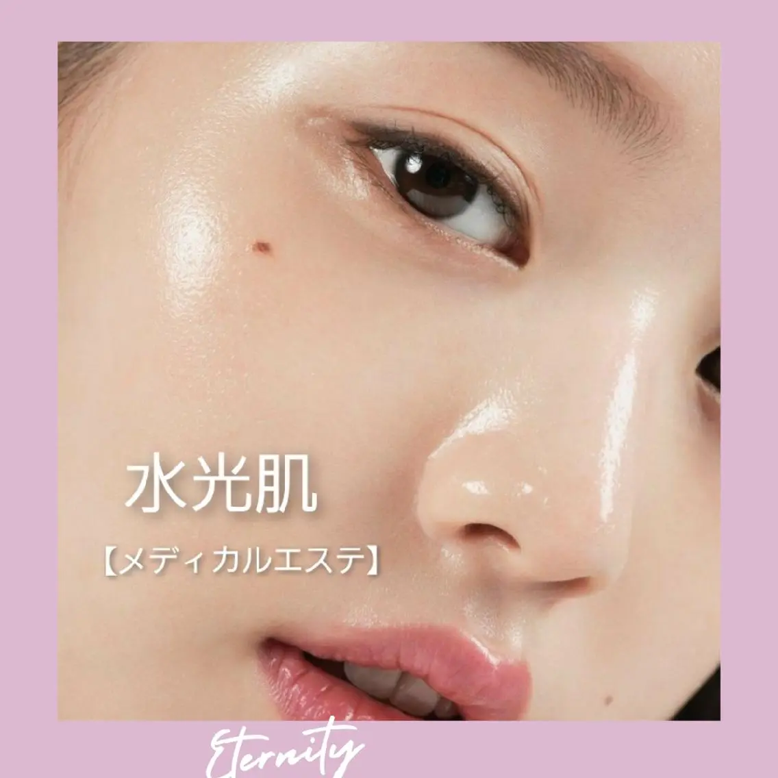 脱毛 【トータル美容】 Eternityのその他イメージ