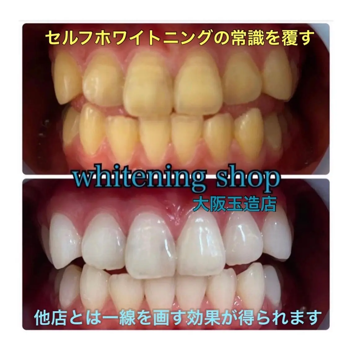 メンズ エステ リラク ホワイトニング ショップ船橋店🦷のエステ・リラクイメージ