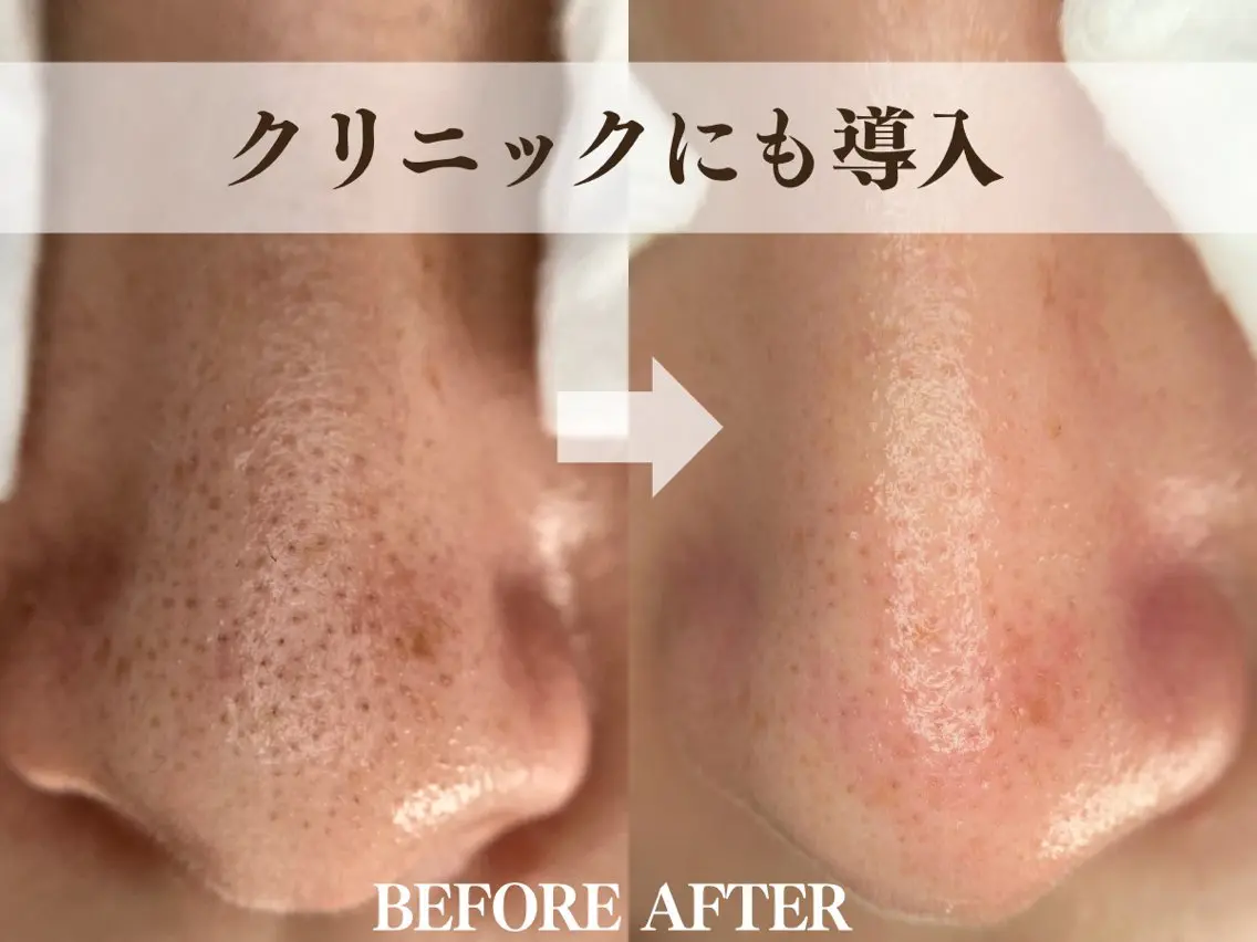 エステ salon MUSUBUのエステ・リラクイメージ