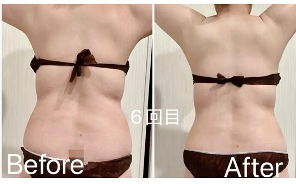 骨盤矯正ダイエット 結果出し＊痩身マシンのエステ・リラクイメージ