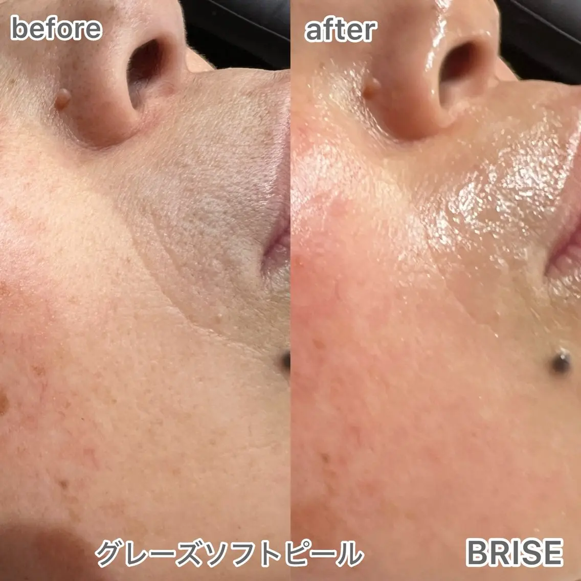 エステ BRISE ブライズのエステ・リラクイメージ