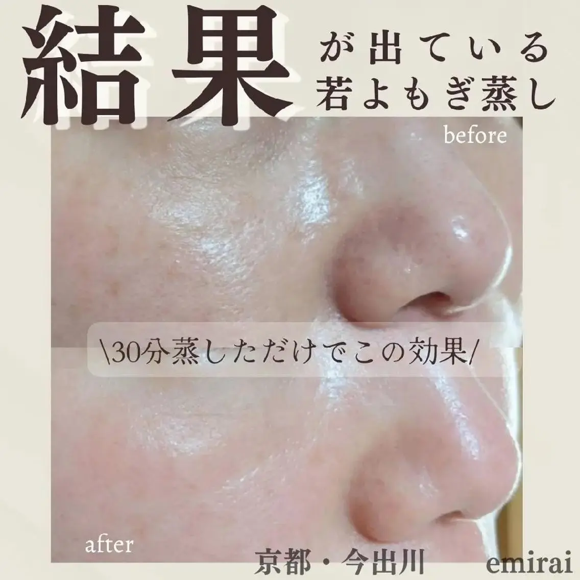 結果が出ている若よもぎ蒸し🌿‬温まるだけじゃない！蒸されるだけでお肌が綺麗に✨全身美容のよもぎ蒸し🧙‍♀️🌿‬の写真