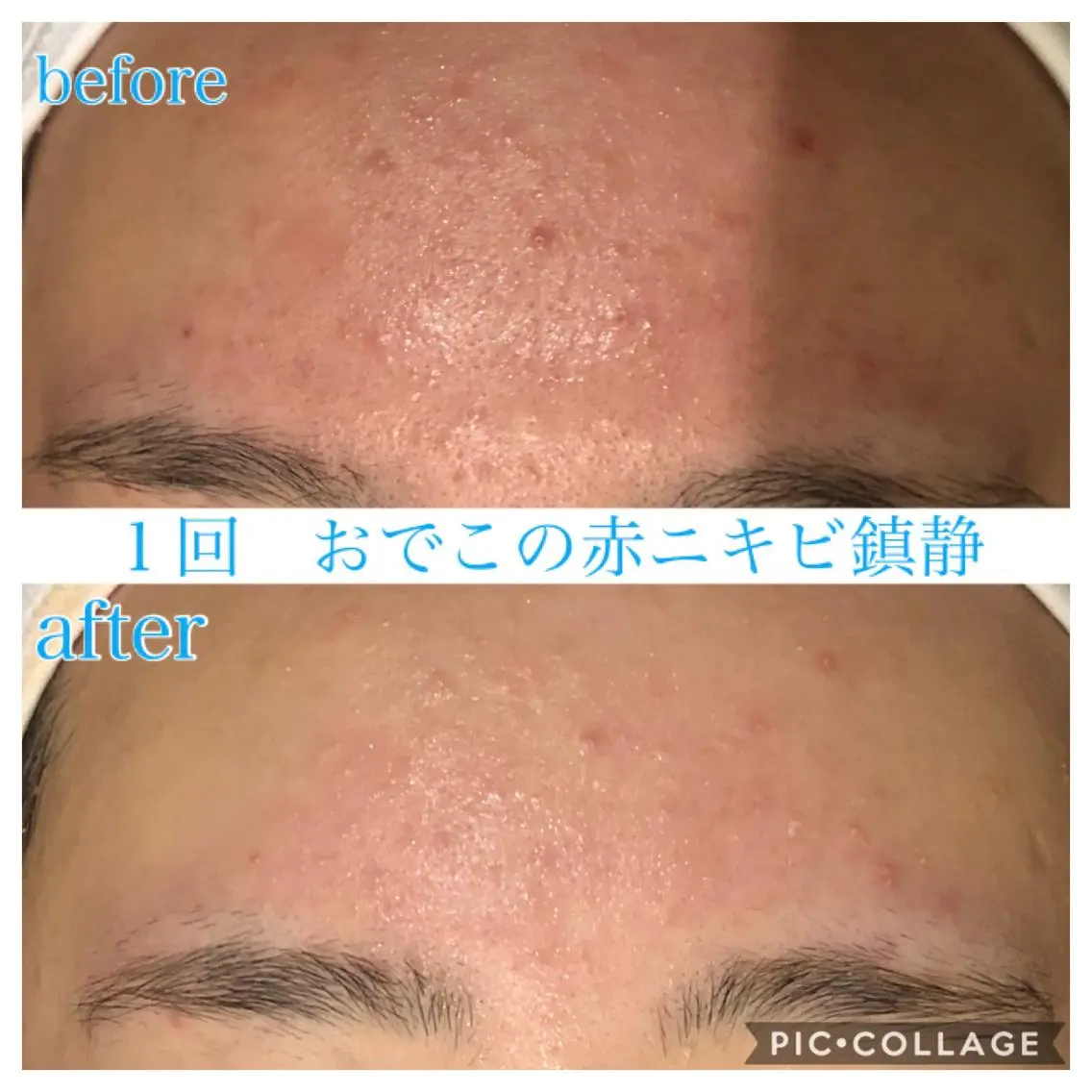 ロング カラー パーマ ヘアアレンジ メンズ キッズ ネイル マツエク・マツパ エステ リラク EnsorClair 代表 野口真央のエステ・リラクイメージ