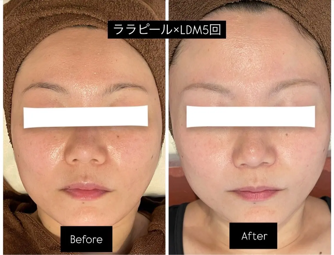Life Salon別府店のエステ・リラクイメージ