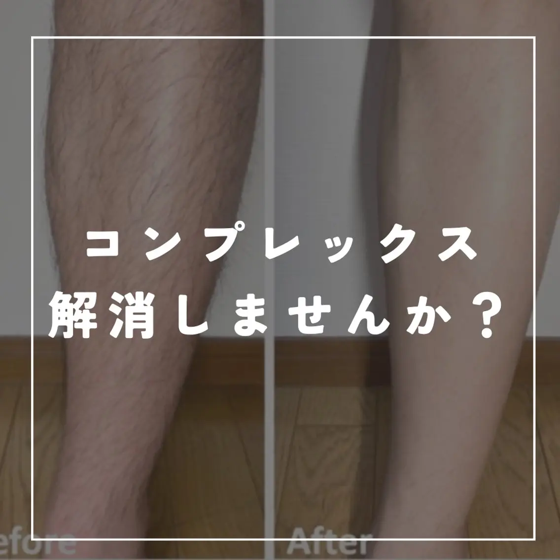 脱毛 脱毛/痩身/頭皮ケア GLYCINEのエステ・リラクイメージ