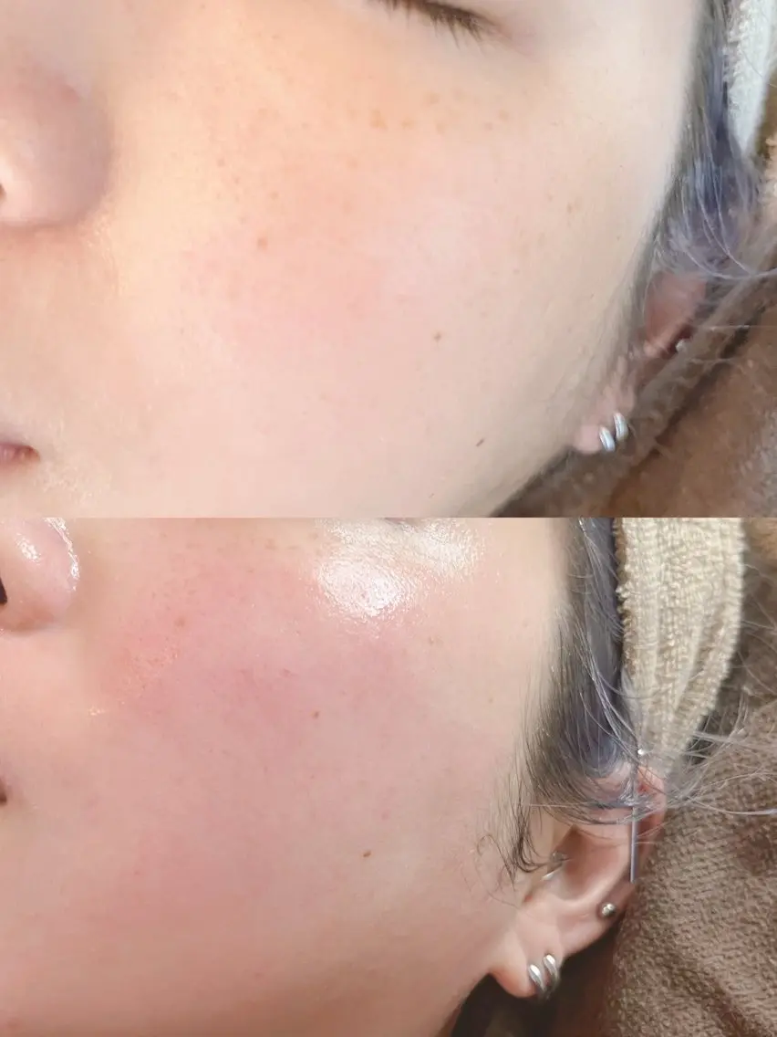 ✨✨期間限定価格✨✨ フェイシャルWAX+クレンジング&保湿パック付きしの写真