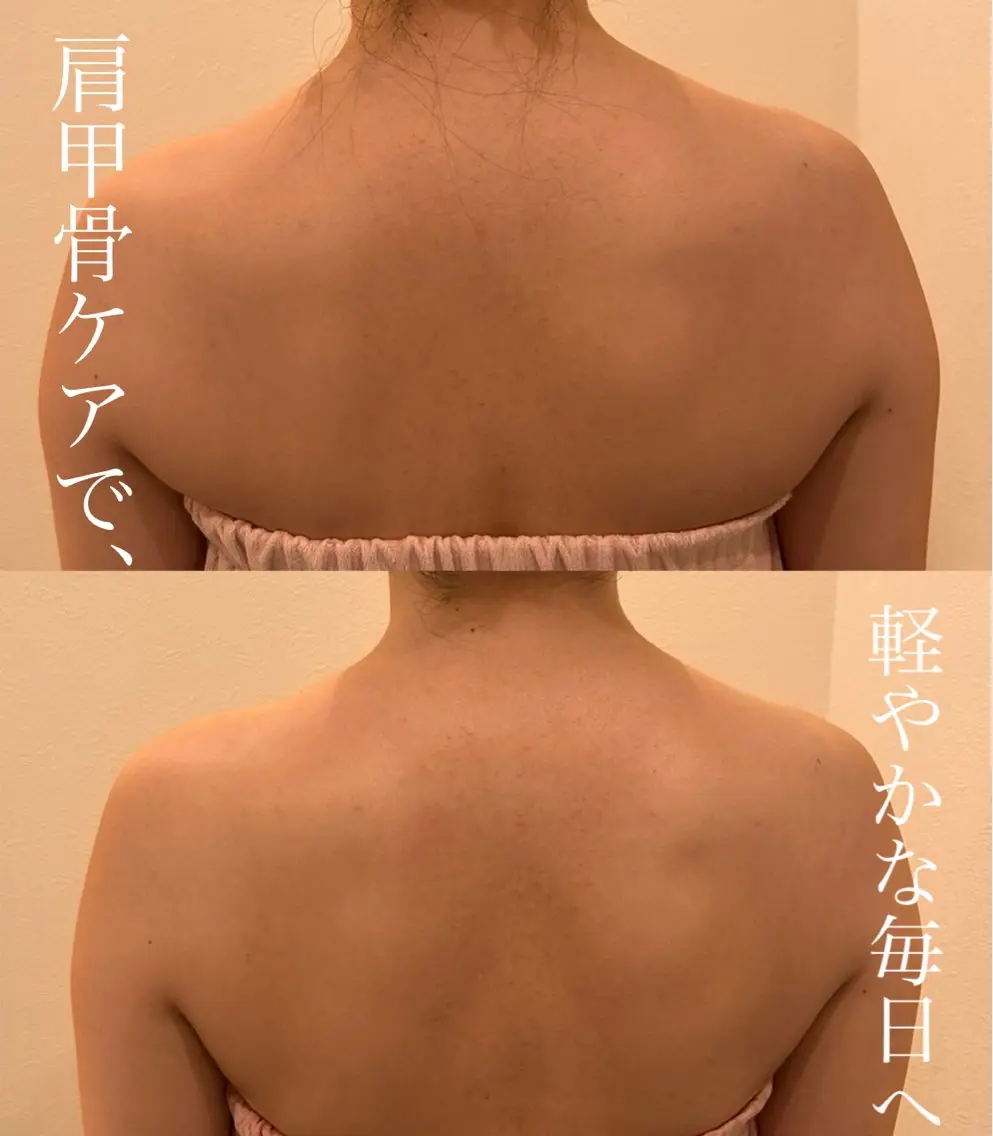 肩こりさん必見当店リピート率No1の写真