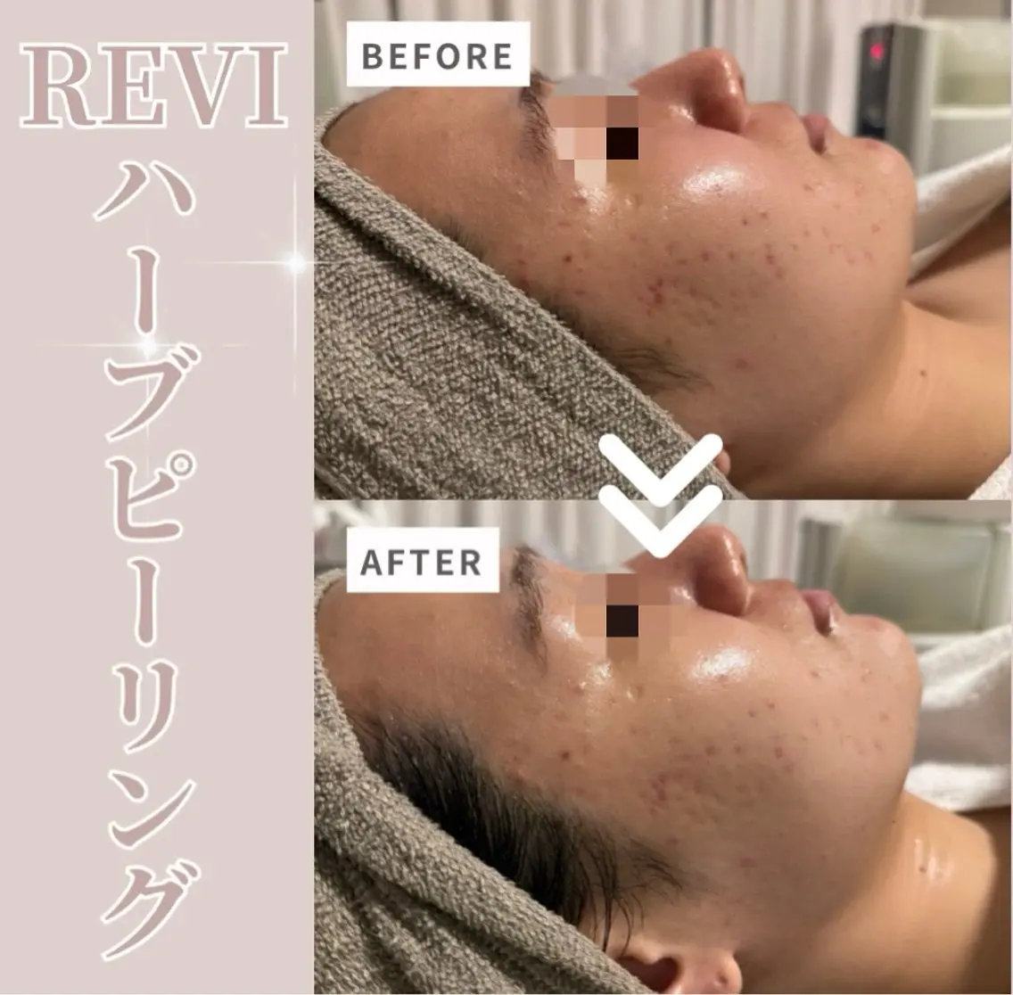lumi riseのエステ・リラクイメージ