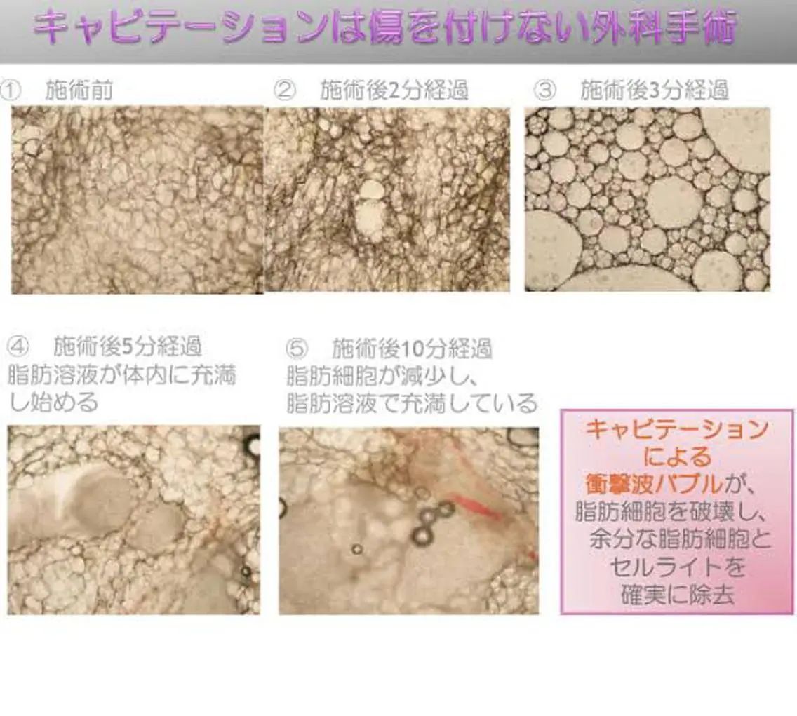 Beauty SalonMireiのエステ・リラクイメージ