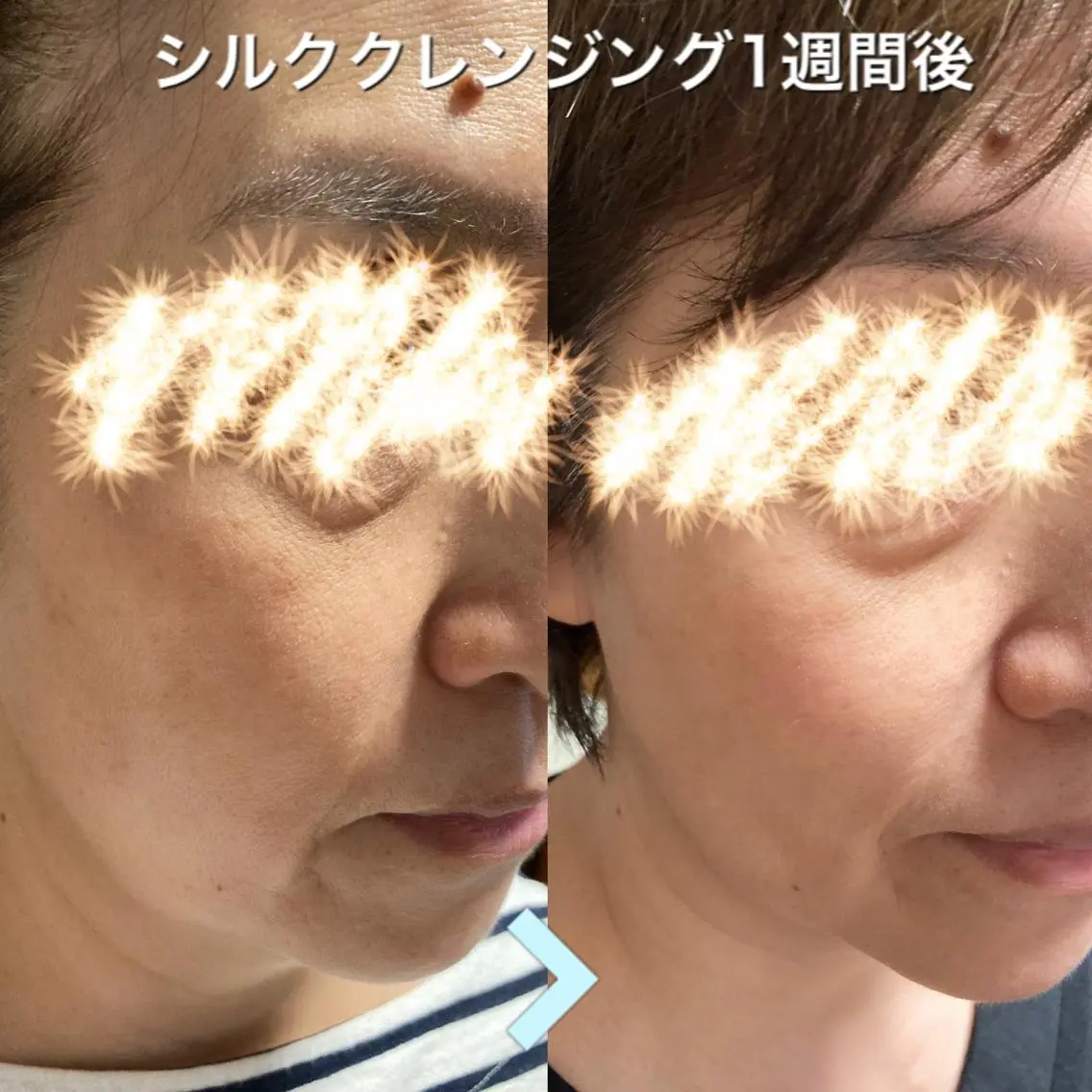 自律神経を整える ボディケアサロンのエステ・リラクイメージ